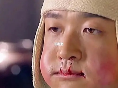 Wei Shen Me Shou Shang De Ren Zong Shi Wo 为什么受伤的人总是我 Why I Always Get Injured Lyrics 歌詞 With Pinyin By Long Ye 龙野Wei Shen Me Shou Shang De Ren Zong Shi Wo 为什么受伤的人总是我 Why I Always Get Injured Lyrics 歌詞 With Pinyin By Long Ye 龙野